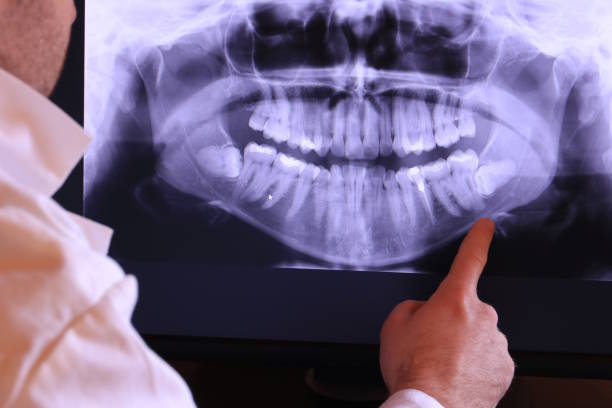 Best Emergency Gum Treatment in Rome City, IN