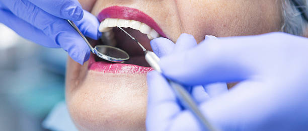 Best Emergency Dental Care for Broken or Chipped Teeth in Rome City, IN